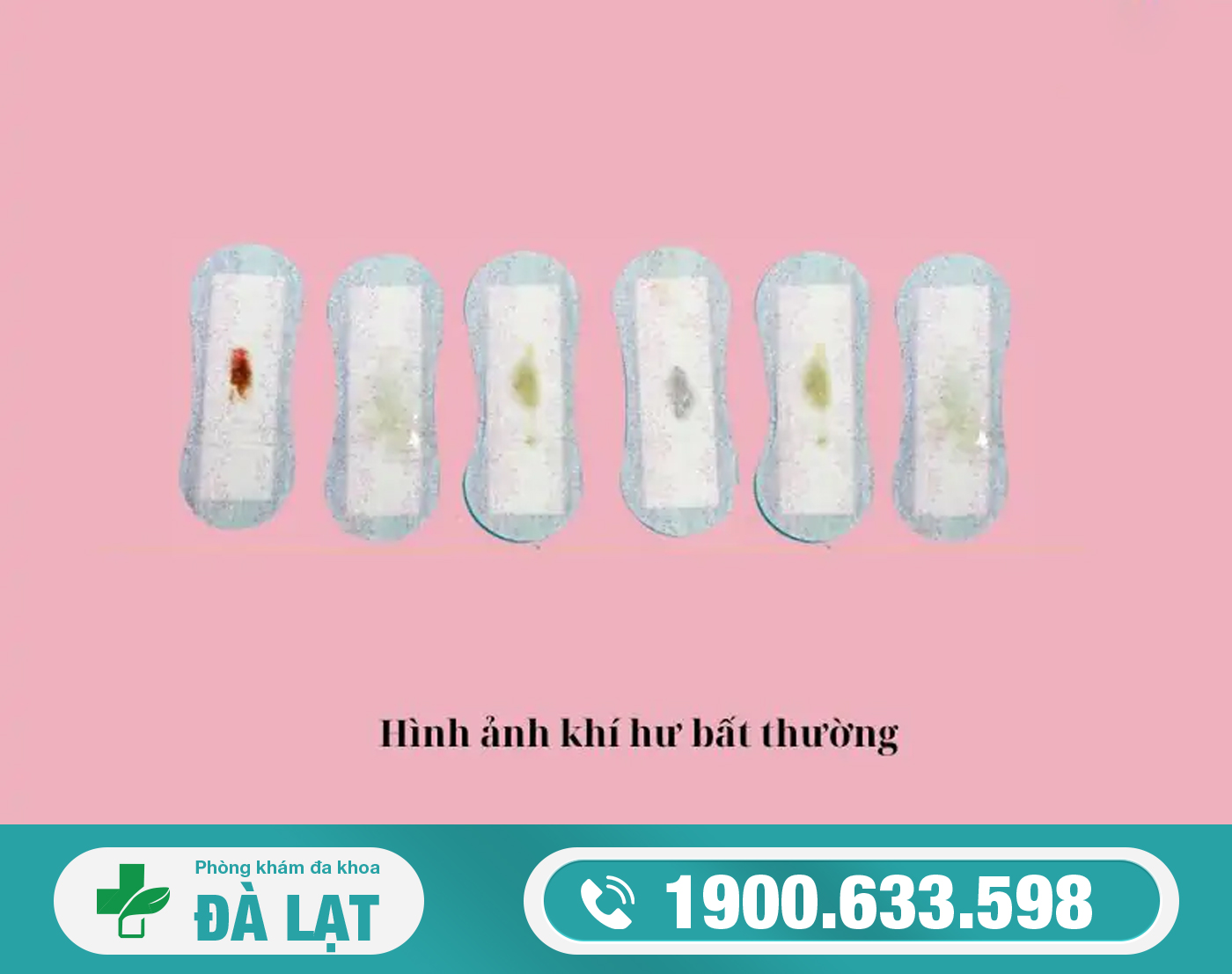 Hình ảnh minh họa